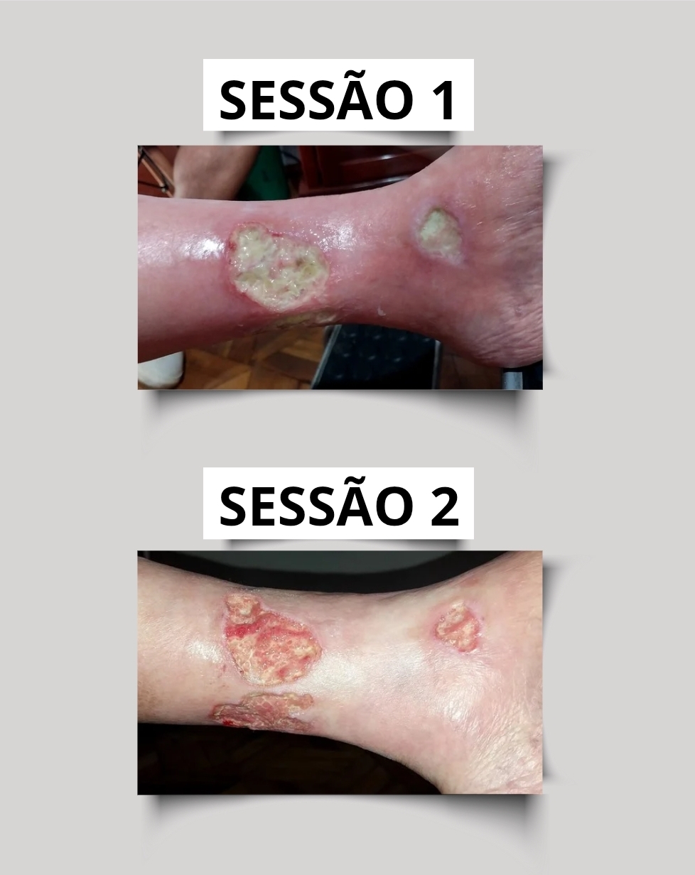 Progressão sessão a sessão